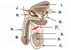 Vasectomy