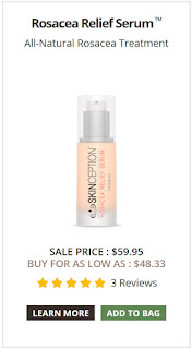 Skinception™ Rosacea Relief Serum can Soothes Your Red, Inflamed  Face Skin