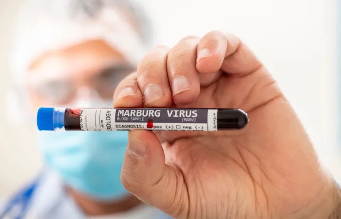 OMS confirma surto do vírus Marburg - um dos mais letais do mundo