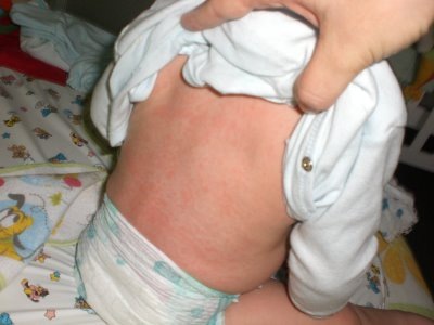 Mae De Negocios Roseola Voce Sabia Que Ela Existe Mae De Negocios Roseola Voce Sabia Que Ela Existe