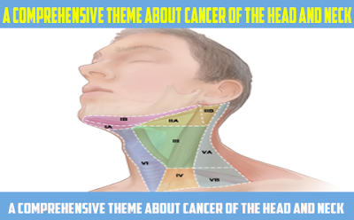 Facts about head and neck cancer 