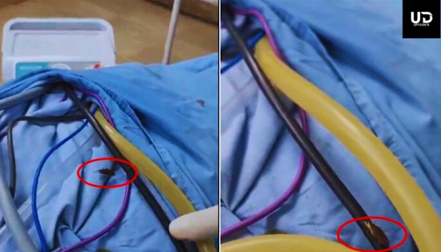 Peshawar: A video of a red bag walking on a patient during a kidney disease surgery has gone viral