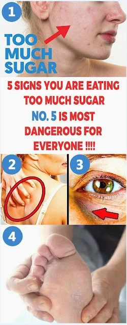 Top 5 signs you are eating too much sugar + what to do about it