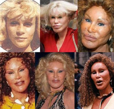 Jocelyn Wildenstein Before And After