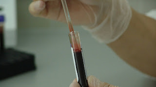 Blood sample