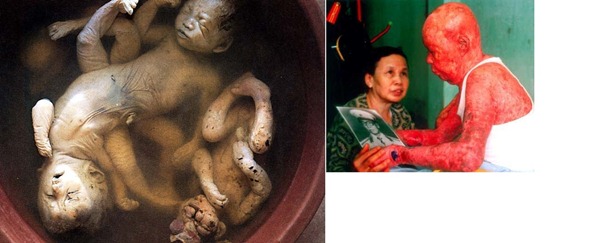 Agent-orange-dead-deformed-babies