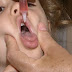 Mato Grosso| Campanha de vacinação contra sarampo e poliomielite começa em 6 de agosto