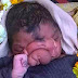 Indians Worship Baby Born With 'Elephant Trunk' Deformity
