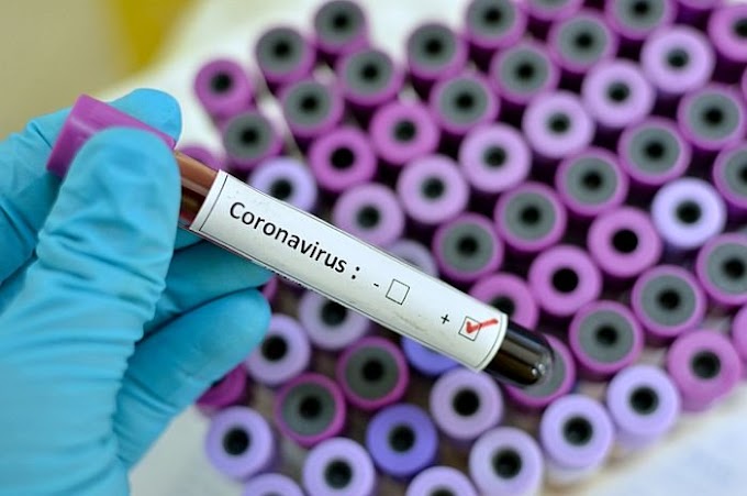 BREAKING: Nigeria confirms 14 new coronavirus cases — raising total to 65