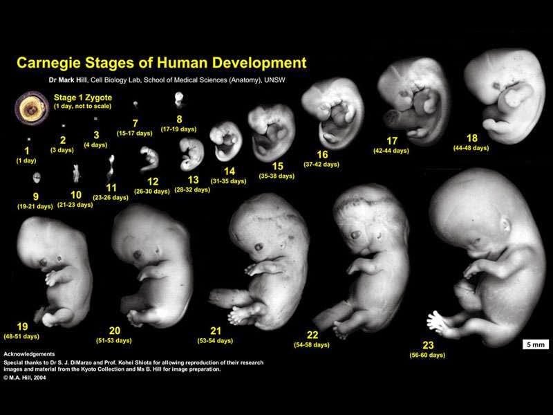 http://www.webmd.com/baby/ss/slideshow-fetal-development