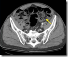 pemeriksaan radiology pemeriksaan radiology abdomen