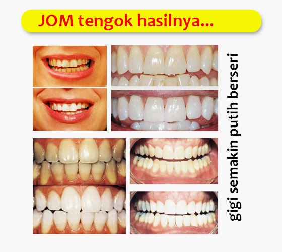 Ingin Cantik: ISME RASYAN HERBAL CLOVE TOOTHPASTE