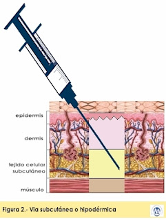 Resultado de imagen de via subcutaneo