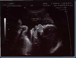 Landon_Profile_Pict