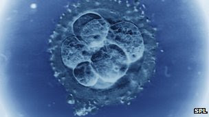 Image: Super-fertility offers clue to recurrent miscarriage