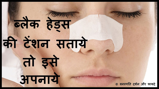 Blackheads ki Tension Sataye to Ise Apnaayen