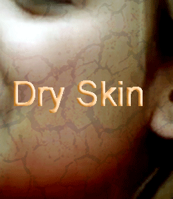 Turmeric face pack for dry skin