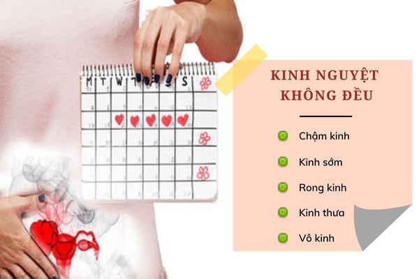 điều trị kinh nguyệt không đều tại Nghệ An