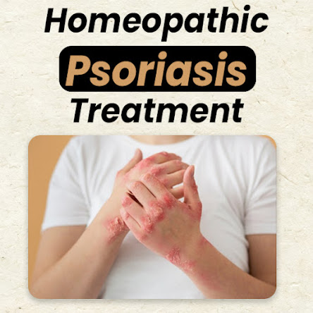 homeopathic psoriasis treatment