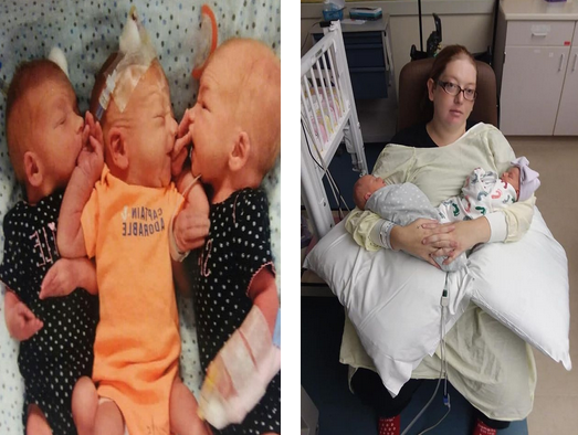 Woman thought she had kidney stones but gives birth to triplets instead 
