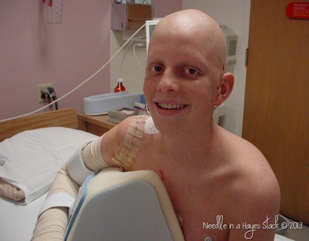Nick's big scar with smile