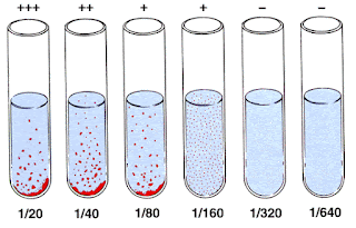 Widal test result