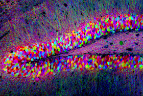 Hippocampus brainbow
by Tamily Weissman, Harvard University