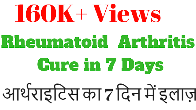 Rheumatoid Arthritis | Symptoms | Causes | Treatment | Exercise | Diet - A complete guide | ft. Nitin Bhavsar