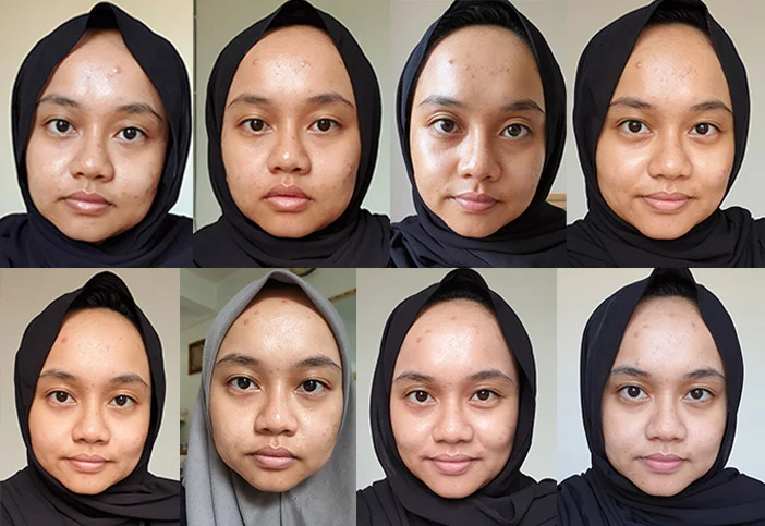 Results Using Korean 10-Step Skincare Routine After 2 Months