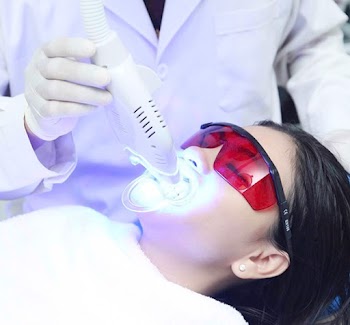 Tẩy trắng răng bằng cách nào an toàn?