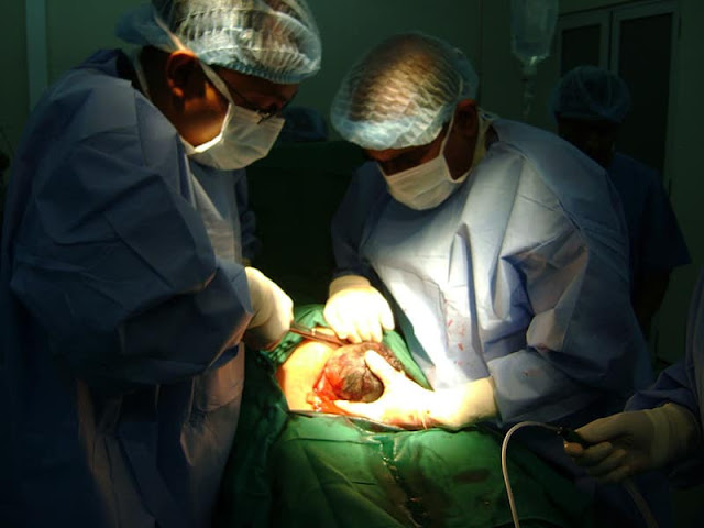 Cyprus among countries with the highest c-section rates in the world