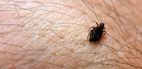Pleshtat e shtratit: Metoda të thjeshta për t'i zhdukur ato nga shtëpia juaj