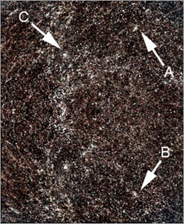 Search Term Density Detail