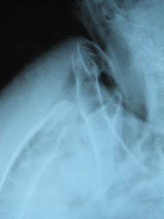 eagle x ray