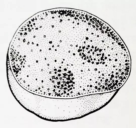 लाइसोसोम(Lysosomes):General Introduction,Structure,Origin,function|hindi