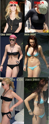 lindsay lohan before and after