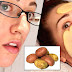 How To Use Potato To Fade Black Spots On Your Face