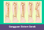 Jenis-Jenis Kelainan, Gangguan Dan Penyakit Pada Sistem Gerak Manusia