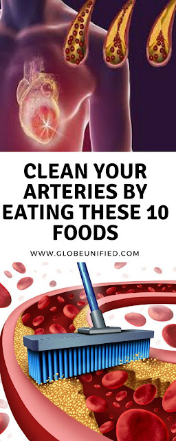 Clean Your Arteries By Eating These 10 Foods