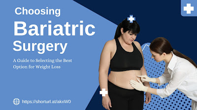 Bariatric surgery - checker products