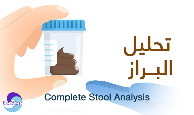 Complete Stool Analysis