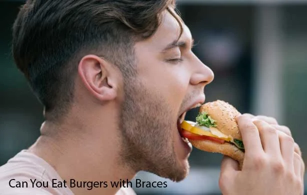 Can You Eat Burgers with Braces and What Need to Avoid