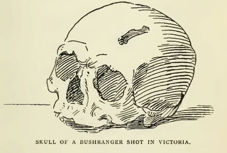 Skull of a Bushranger Shot in Victoria - The Bushrangers - Part Seventeen - Dignum and His Gang