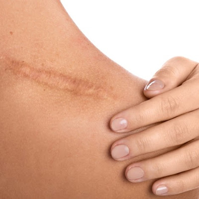 #Grief leaves a mark on us like a scar.