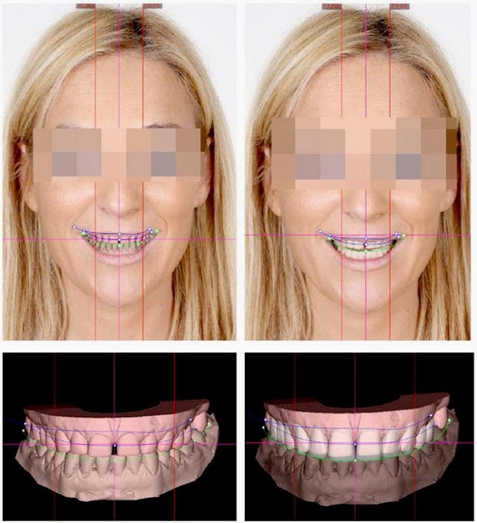 NOTIDENTAL: La planificación digital de la sonrisa camino a la masificación