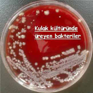 kulak kültürü üreyen bakteriler.