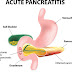 Pancreatita acută 