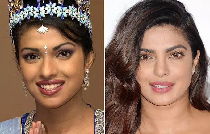 Bollywood Celebrities Before And After Cosmetic Surgery  And Nose Jobs