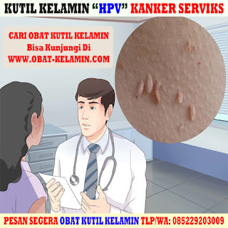 obat kutil kelamin