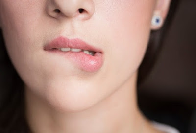 Cara mengatasi bibir bengkak, penyebab bibir bengkak, obat bibir bengkak